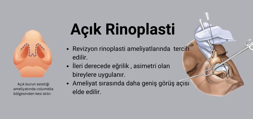 Açık Rinoplasti - Antalya