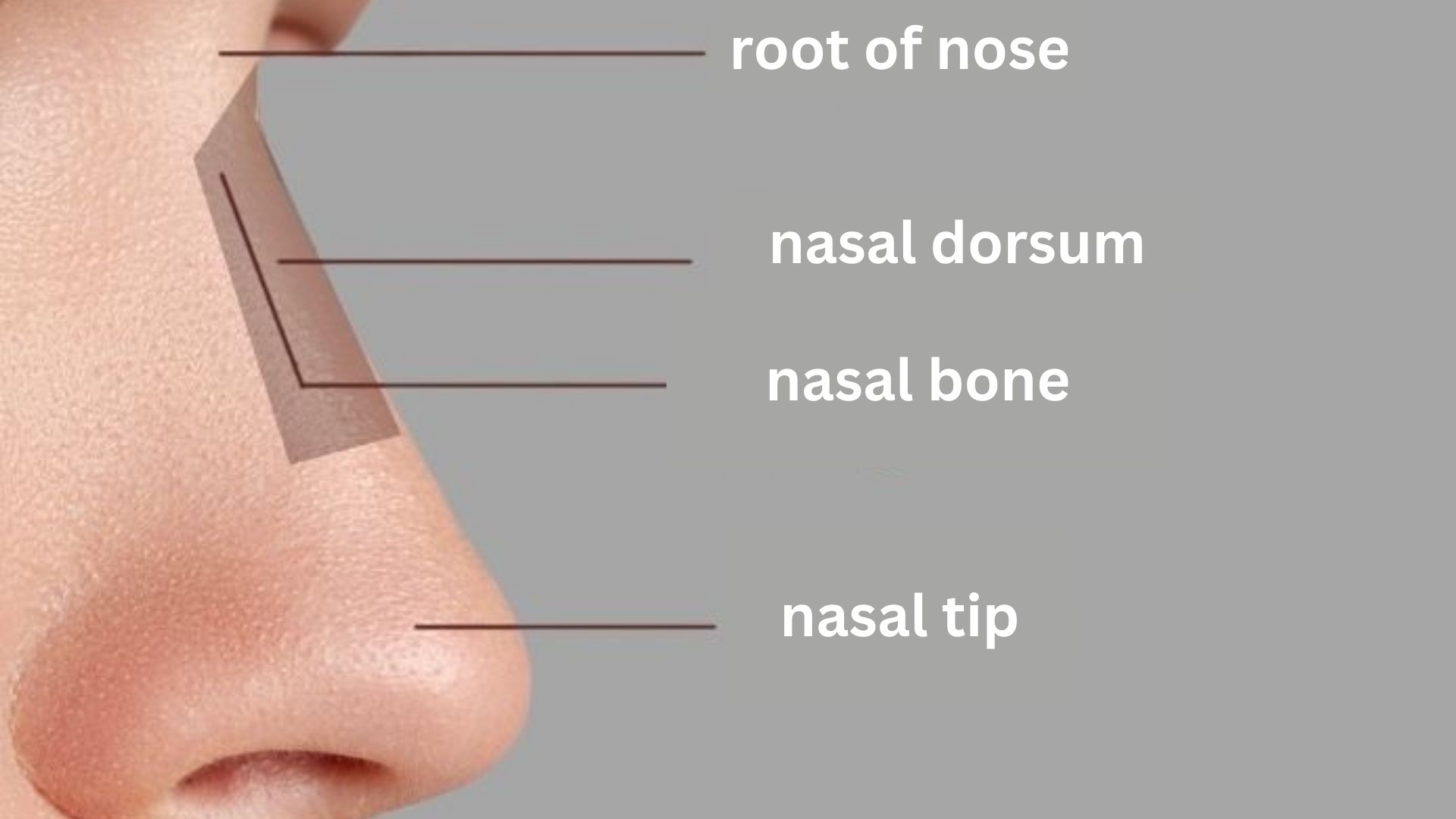Suitable nose types for arched nose surgery