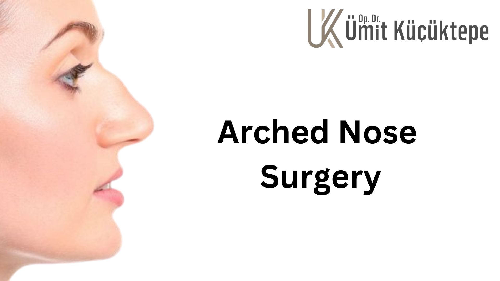 arched-nose-surgery-turkey-antalya