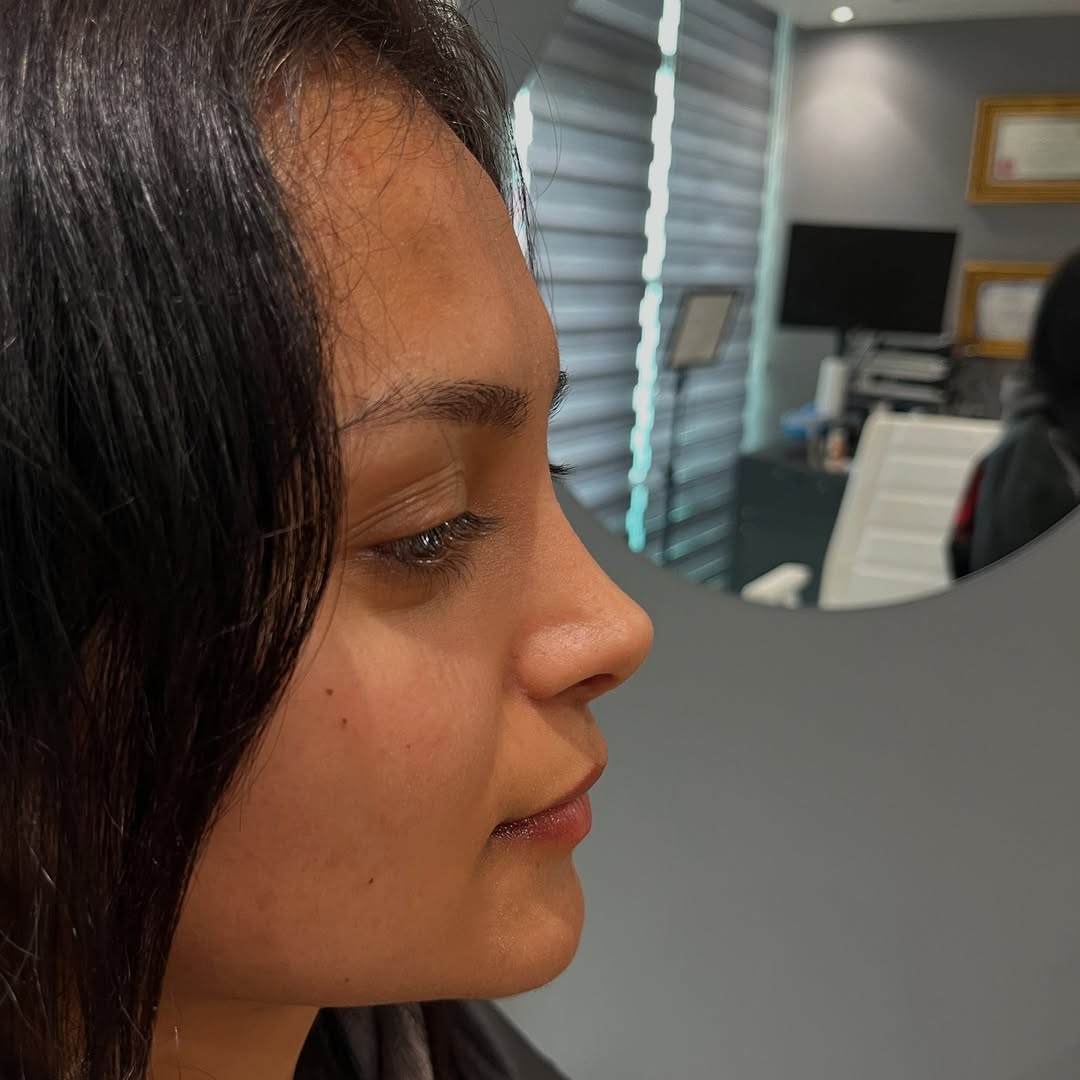 barbie-nose-8 barbie-8