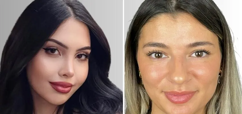 Barbie Burun mu, Doğal Burun Estetiği mi? -  Antalya