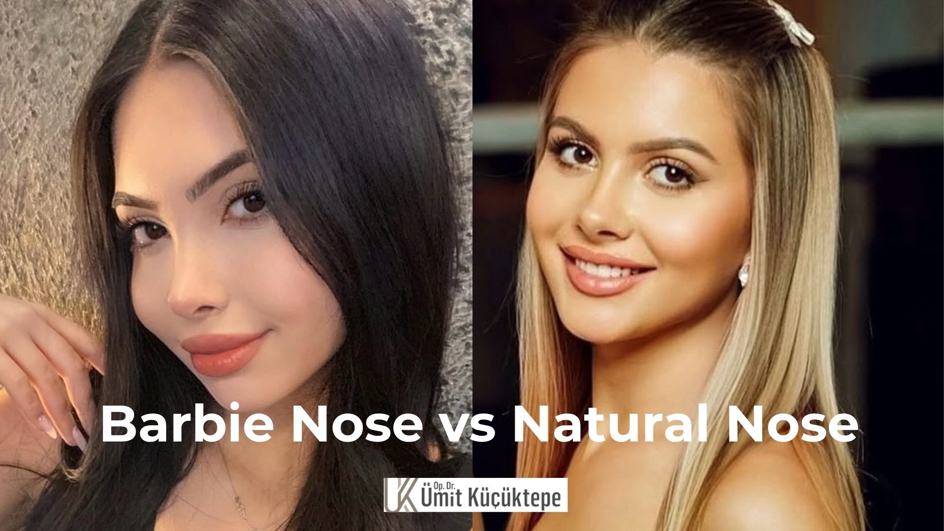 barbie-nose-vs-natural-nose-job