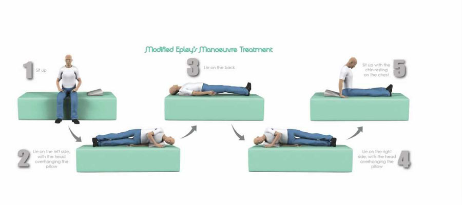 Evde Vertigo Egzersizleri Nasıl Yapılır? Brandt-Daroff Manevrası Nasıl Yapılır? Antalya
