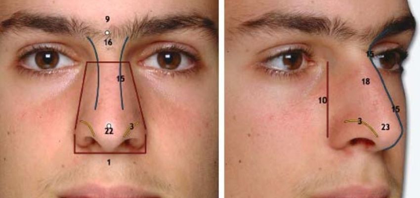 Burun bölümleri - Antalya