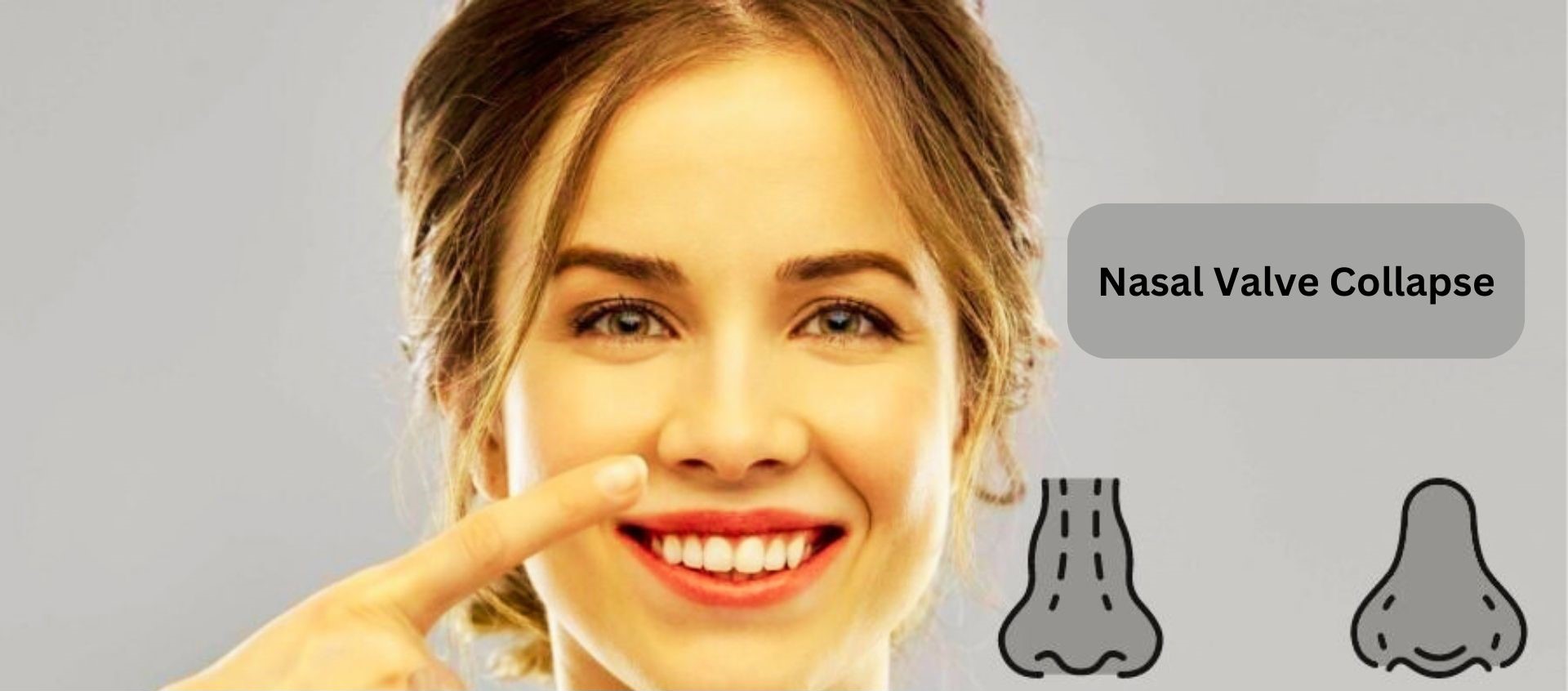 Nasal Valve Collapse Nasal Valve Collapse in Turkey Antalya