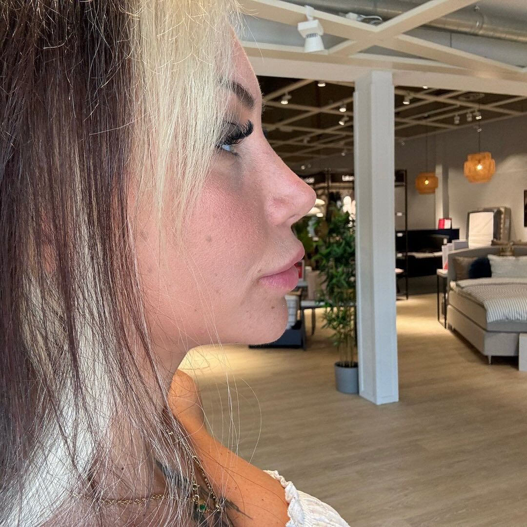 natural-nose-11 natural-nose-11