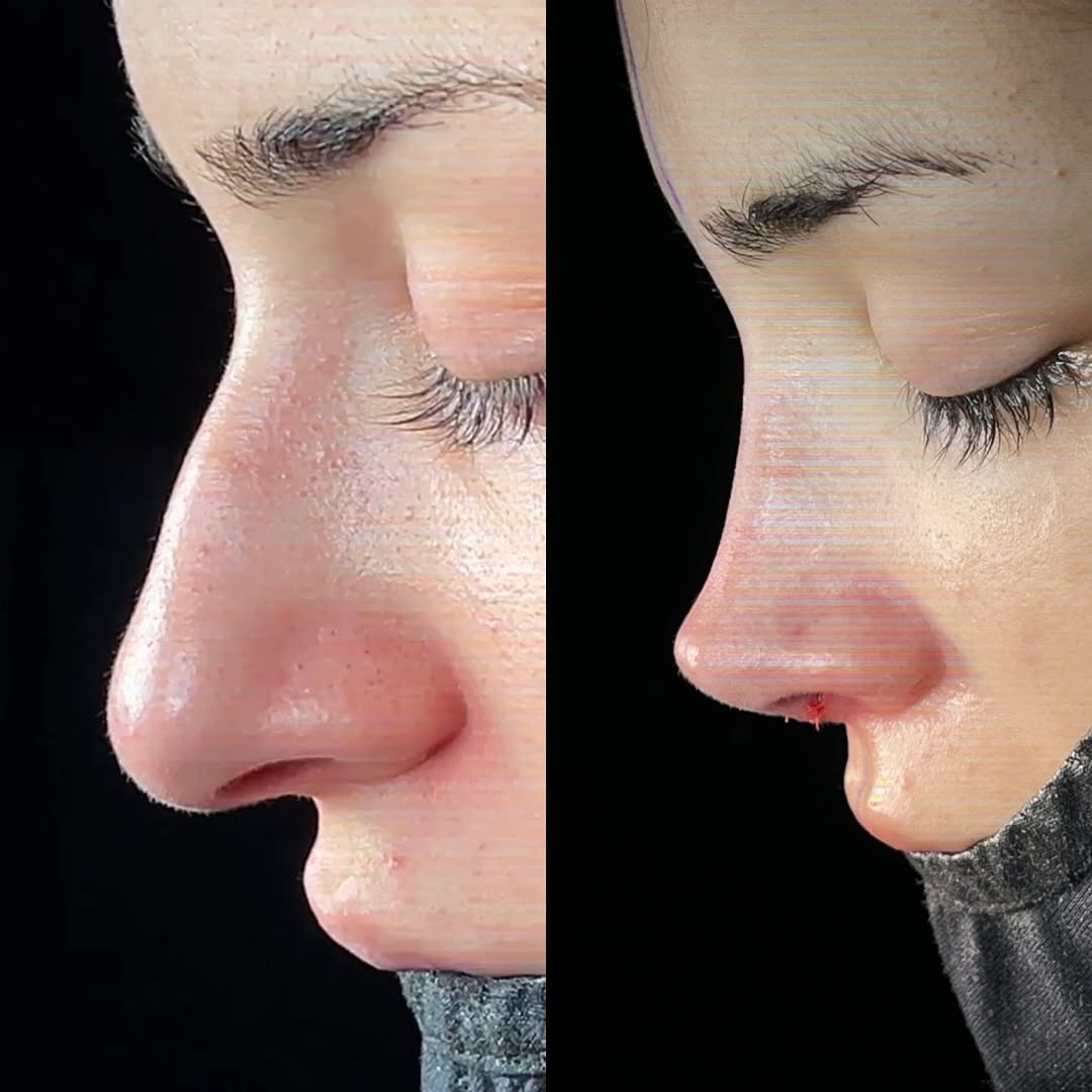 natural-nose-12 natural-nose-12