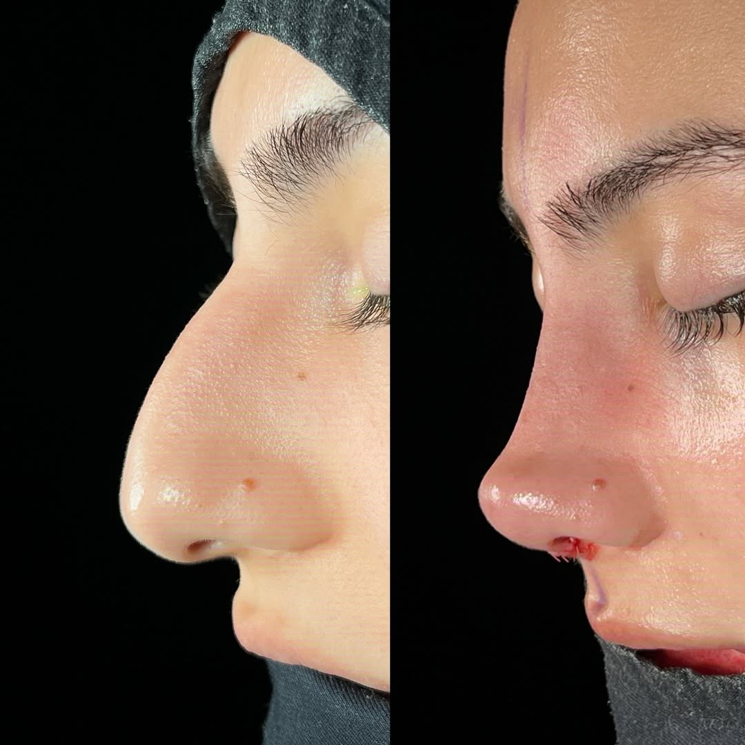 natural-nose-13 natural-nose-13