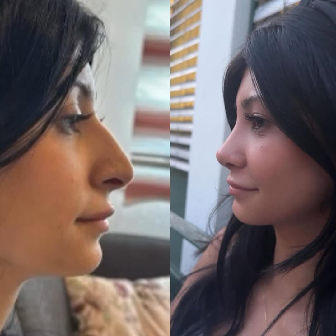 natural-nose-14 natural-nose-14