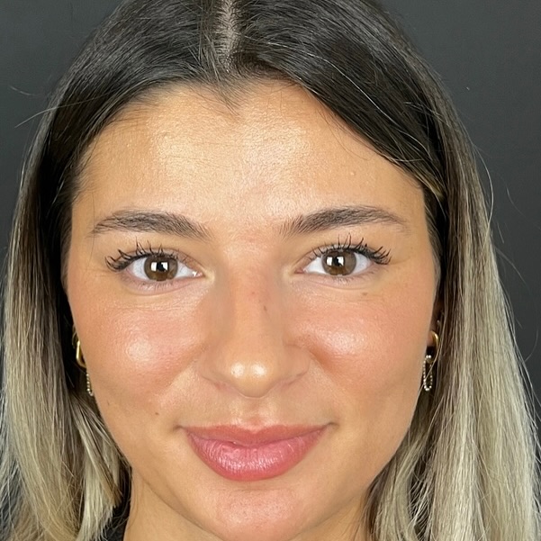 natural-nose-4 natural-nose-4