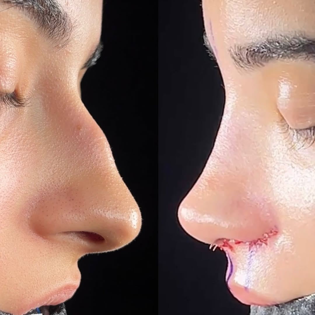 natural-nose-9 natural-nose-9