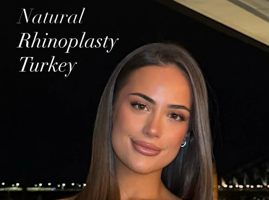 natural-rhinoplasty-turkey-antalya