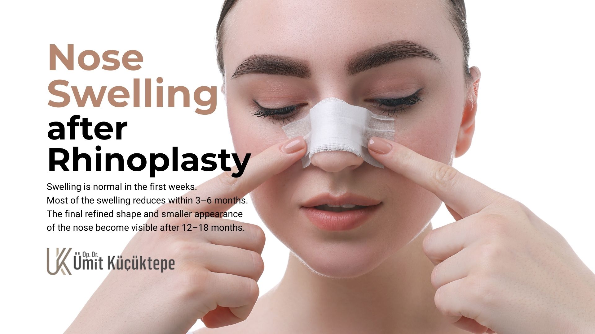 when-will-my-nose-get-smaller-after-rhinoplasty