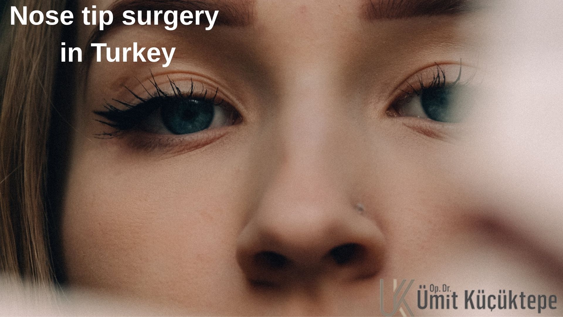 nose-tip-surgery-turkey