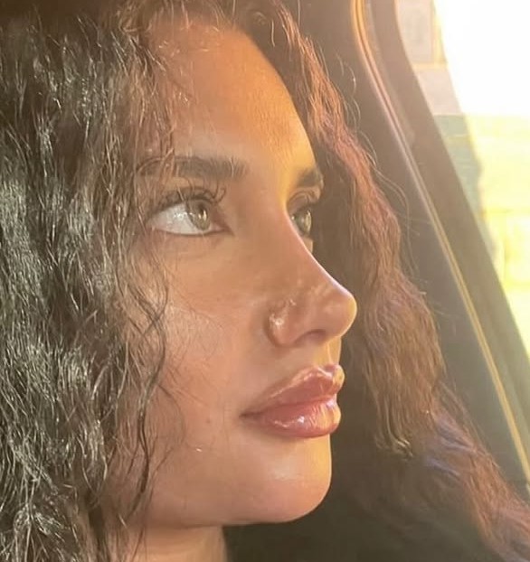 2 months post-surgery