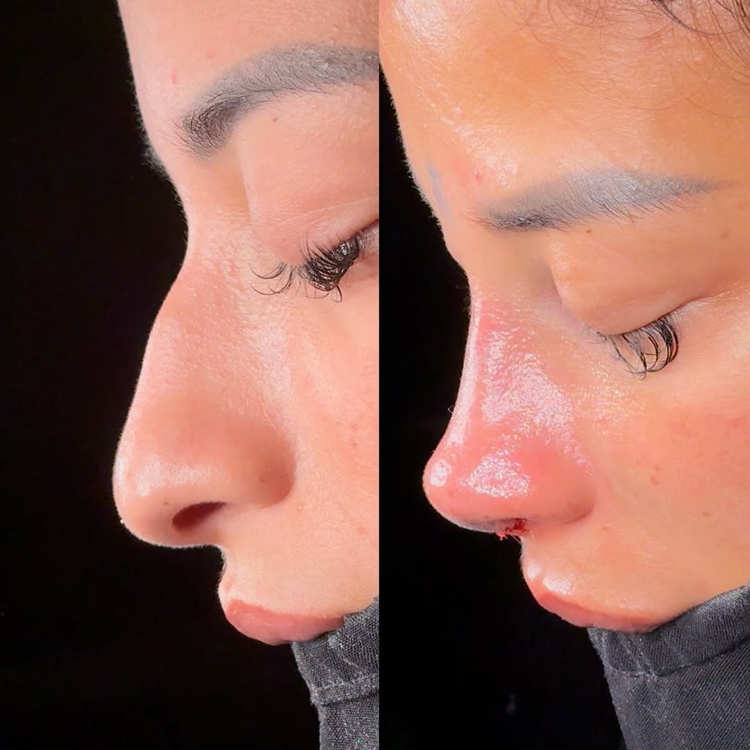 Natural woman nose style Natural woman nose style