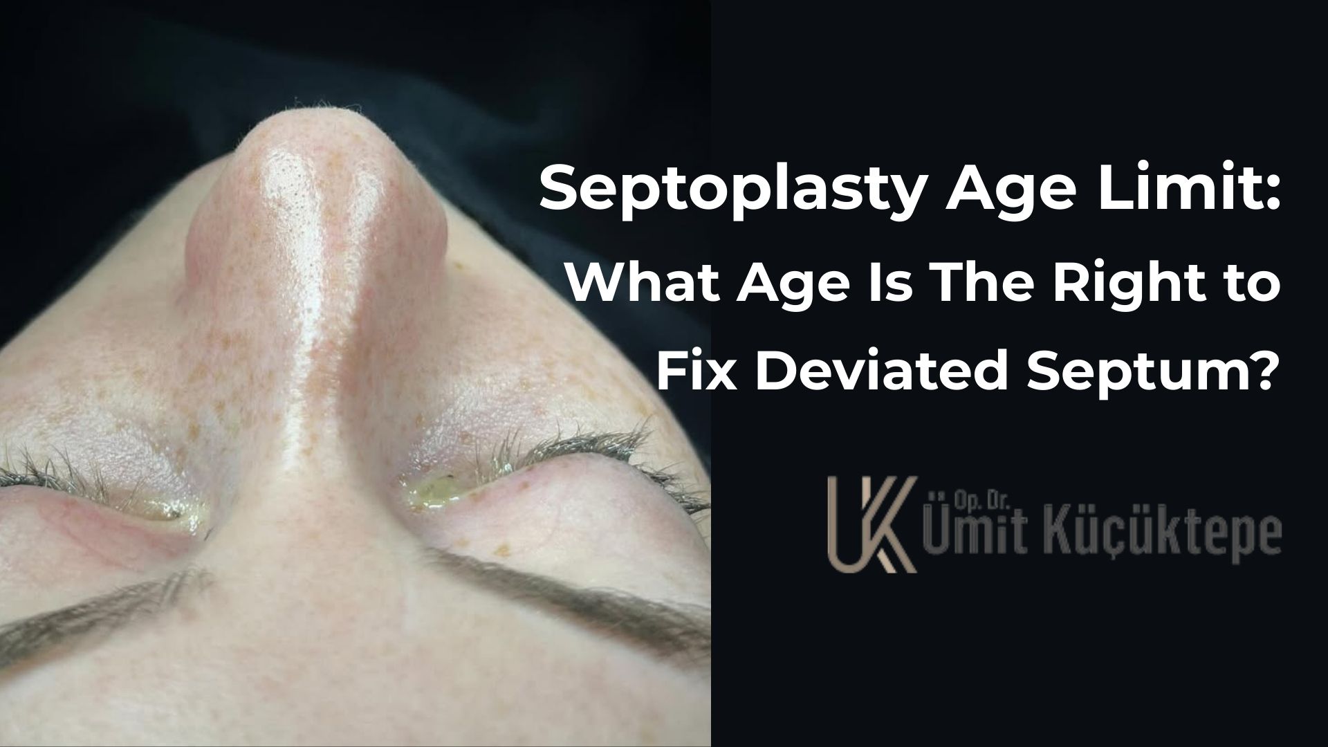 septoplasty-age-limit