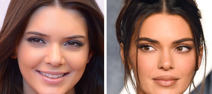 Kendall Jenner's eyes before and after