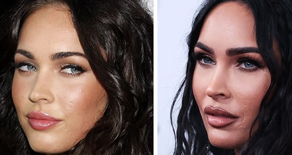 Megan fox eye surgery before and after