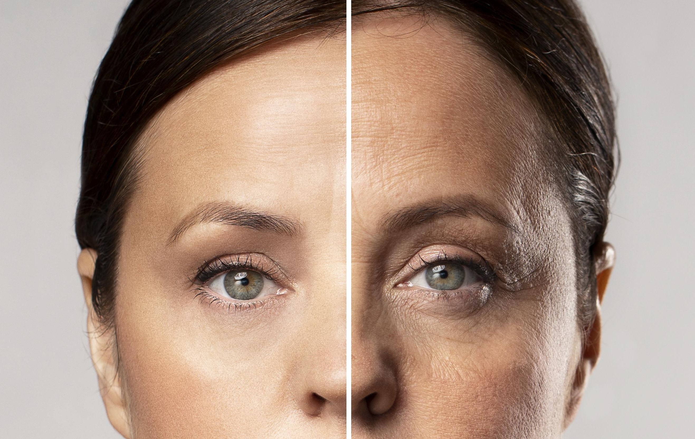 What are the benefits of an endoscopic temporal lift?