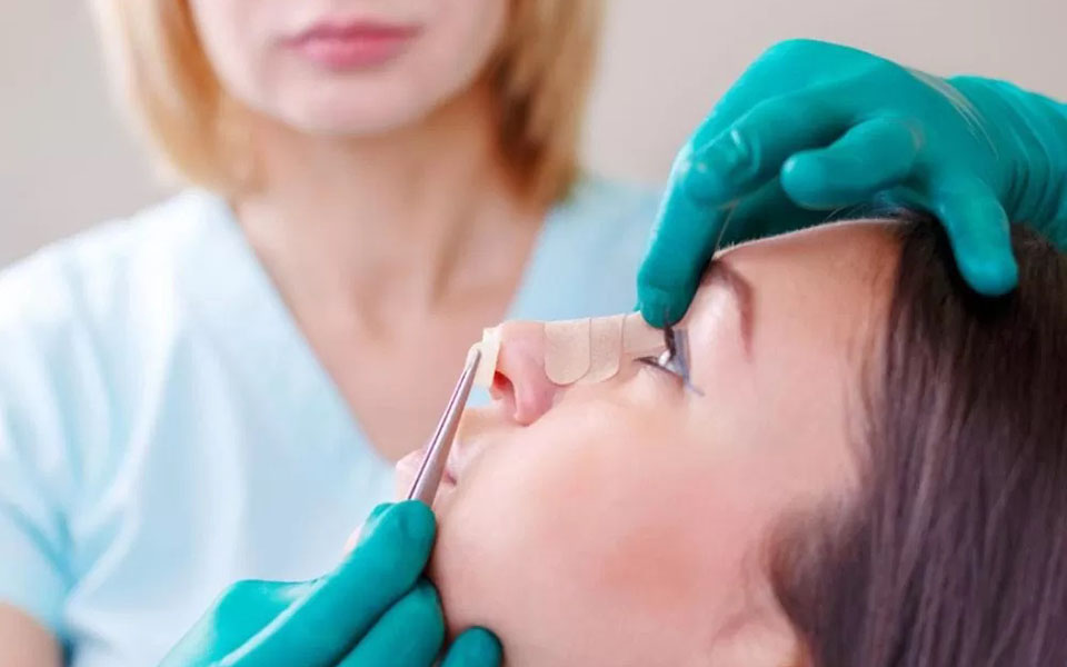 Konka Hipertrofisi Antalya