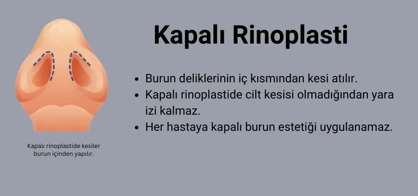 Kapalı Rinoplasti - Antalya